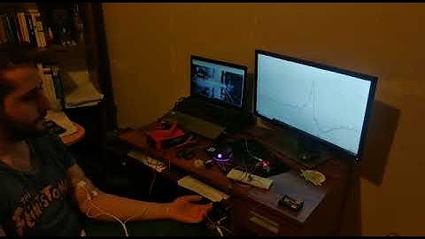Servo Control With EMG Signals - Umutcan Akan YTU Biomechatronic Systems