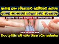 ඇගිලි ඉතා වේදනාකාරී ඉදිමිමකට ලක්වන, ඇගිලි සොසේජස් කරලක් මෙන් වන dactylitis නම් රෝග රැසක රෝග ලක්ෂණය
