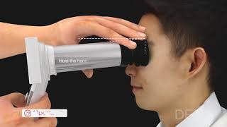 HFC handheld fundus camera operation