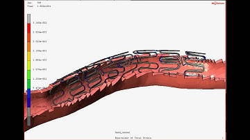 Simulation Video of Nitinol Actuator and Peripheral Stent Deployment and Articulation