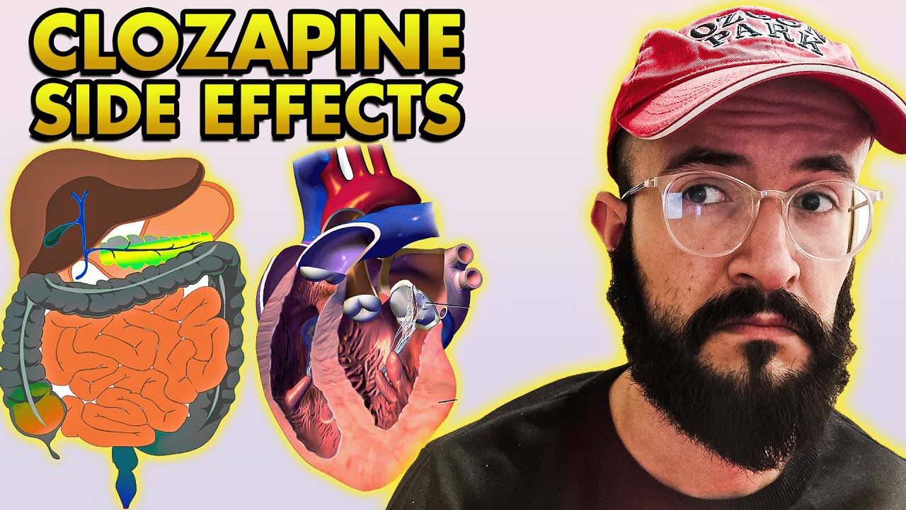 3 Most Serious Clozapine Side Effects