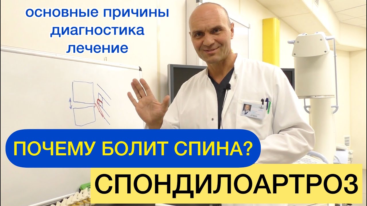 Спондилоартроз позвоночника: причины, симптомы, диагностика, лечение спондилоартроза