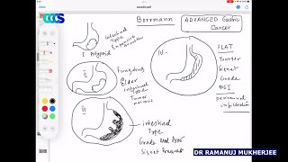 CCC Surgery OSCE - Dr Ramanuj Mukherjee