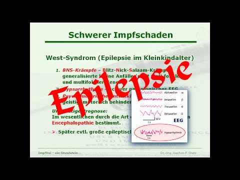 West-Syndrom / Frühkindliche Epilepsie