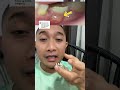 HILANG TIMBUL BISUL DI GUSI GIGI BERLUBANG TERJADI SETELAH MAKAN MANIS #bisuldigusi #gigiberlubang