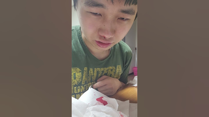 혼자서 코피 빨간물 살려줘 죽었다 ㅠㅠ