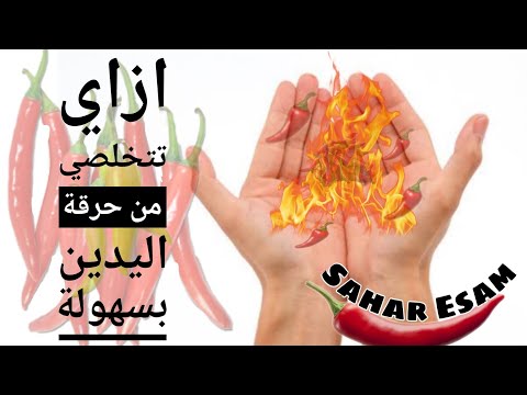 ازاي تتخلصي من حرقة اليد بعد استخدام الفلفل الحار