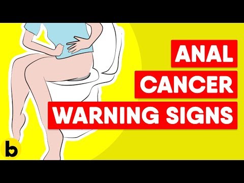 Video: Anal Cancer: Årsaker, Symptomer Og Behandling