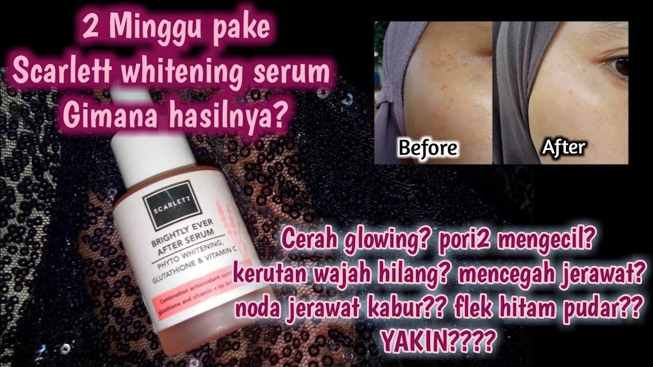 manfaat serum scarlett brightly