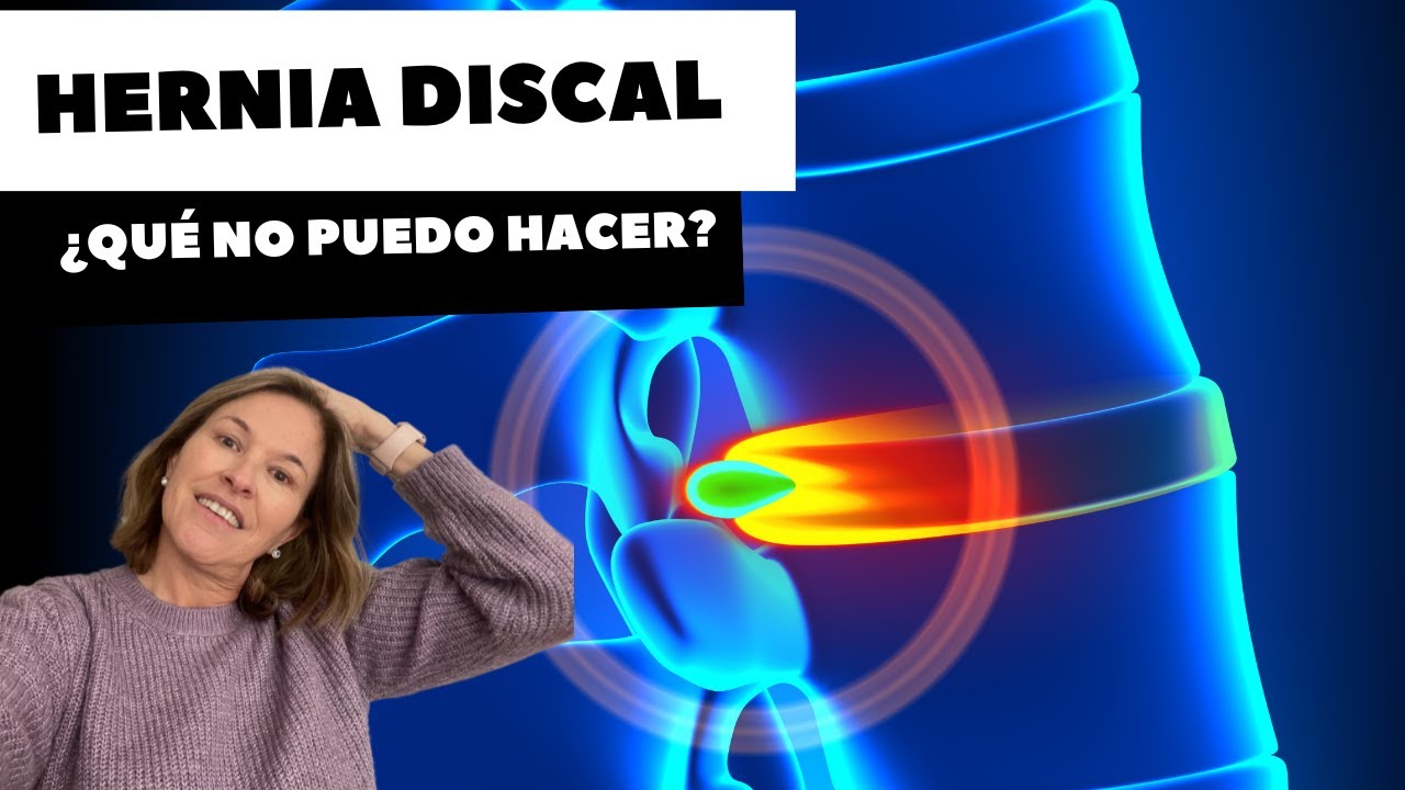 HERNIA DISCAL ¿QUÉ NO PUEDO HACER?