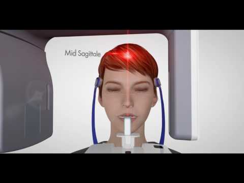 VistaPano S Ceph guidance video - Dürr Dental