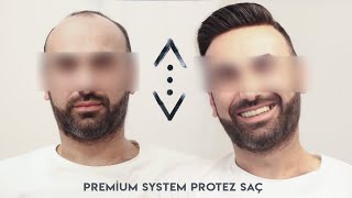 ÇUKUR DİZİ OYUNCUSU  PROTEZ SAÇ YAPTIRDI (PREMIUM SYSTEM)