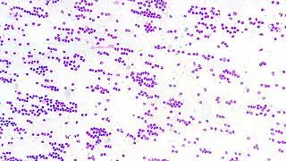 Synovial fluid Windrowing acute suppurative inflammation immune mediated arthrit