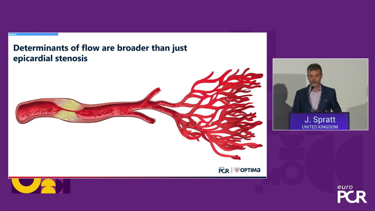 Road to relief - Effective treatment of refractory angina patients with Shockwave Reducer - EuroPCR