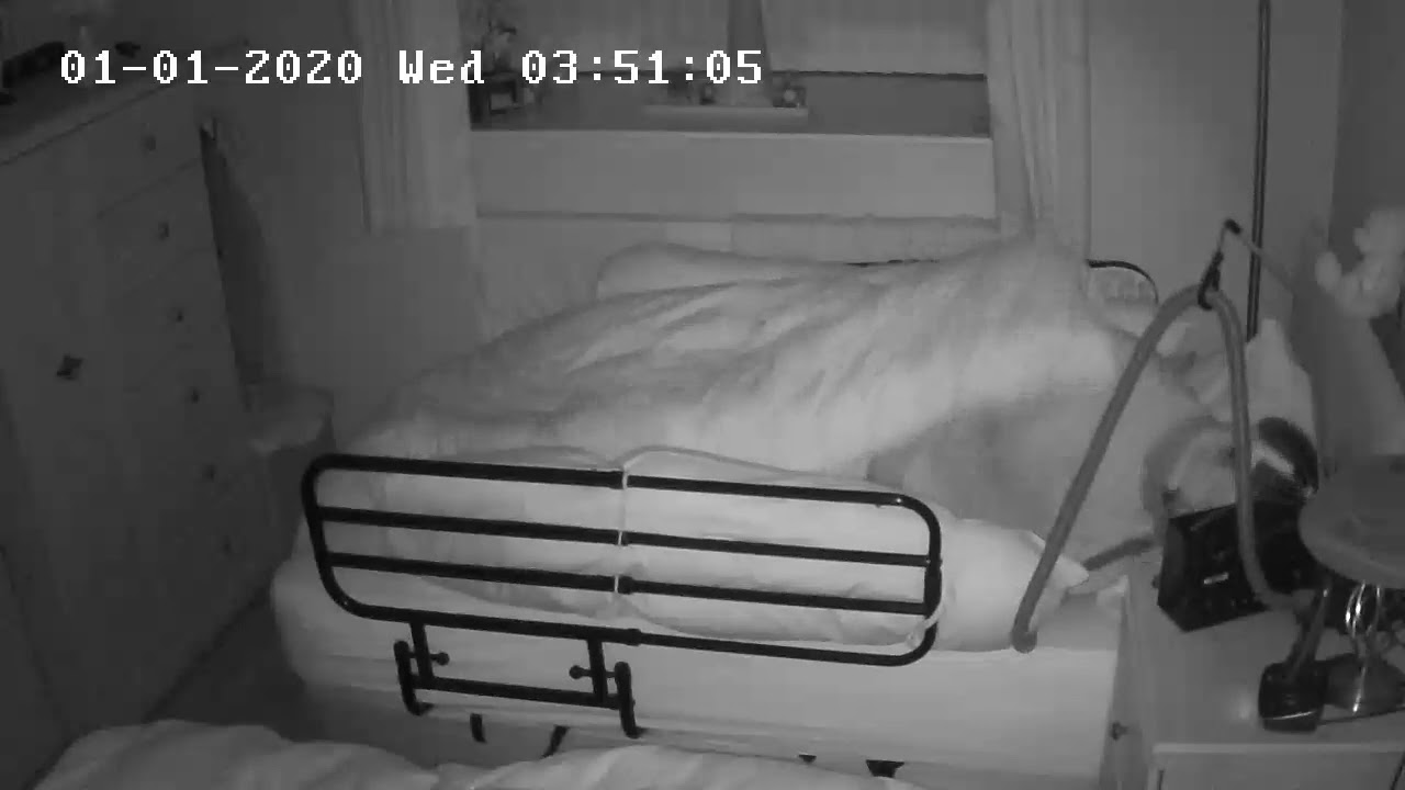 REM SLEEP BEHAVIOR DISORDER JAN 20 (1) YouTube