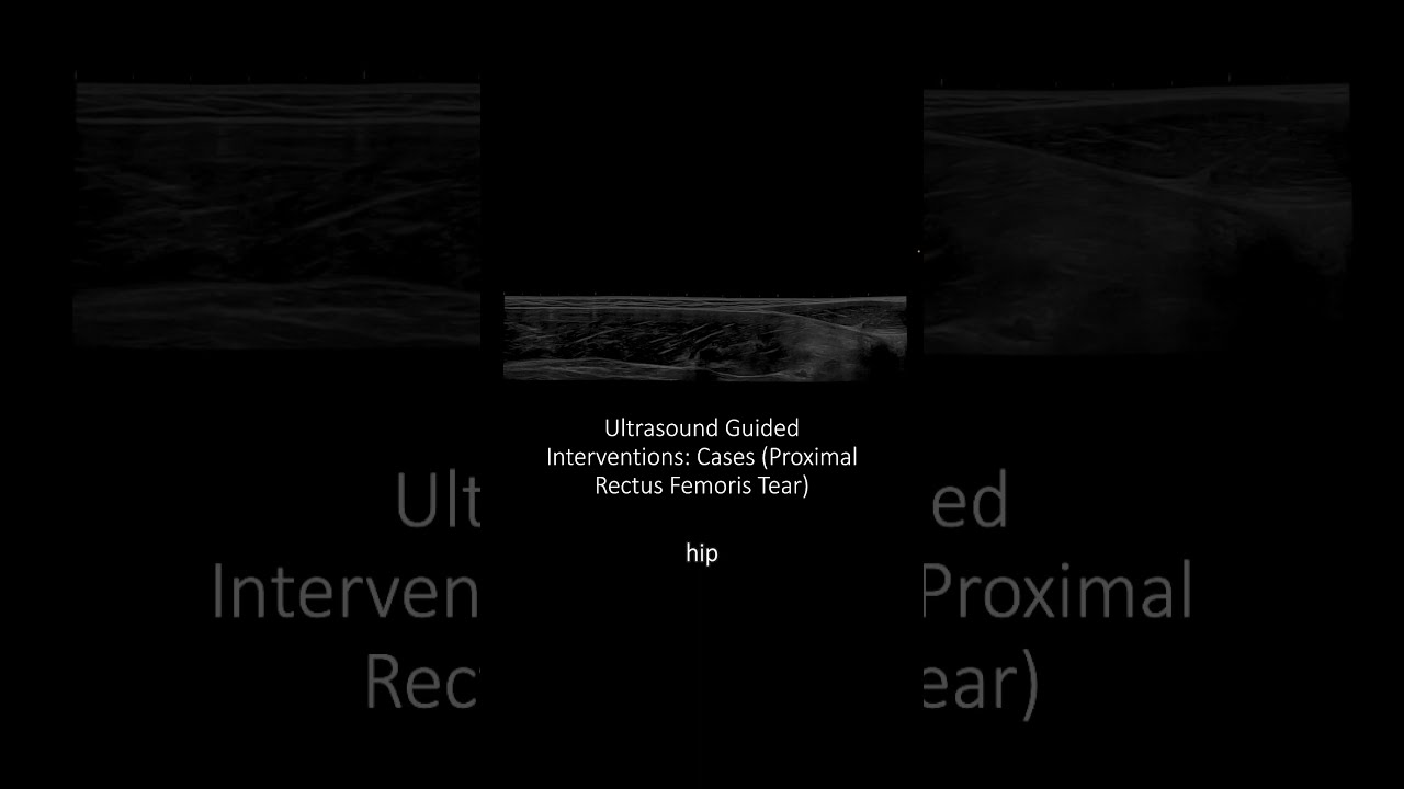 #Ultrasound