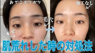 Facial Cosmetic Surgery Grade Makeup Miyu Nghenhachay Net Facial Cosmetic Surgery Grade Makeup Miyu Nghenhachay Net