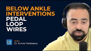 Pedal Loop Wires in Below Ankle Interventions | BackTable Clips screenshot 5