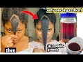 only one ingredient & you hair will never stop growing/the result will shock you😱no more hair loss