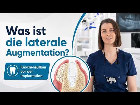 Video: Laterale Augmentation – PureDental Budapest