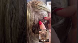 Solución inmediata a la Alopecia femenina!   @totalsecretbycarlaacosta  #alopecia #hairlossproblem