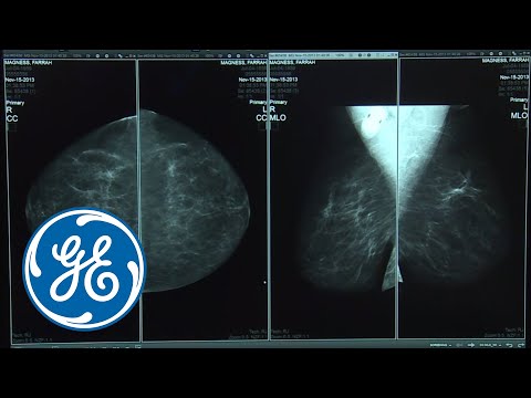 RSNA 2017 – Breast Image Enterprise Viewing solution | GE Healthcare