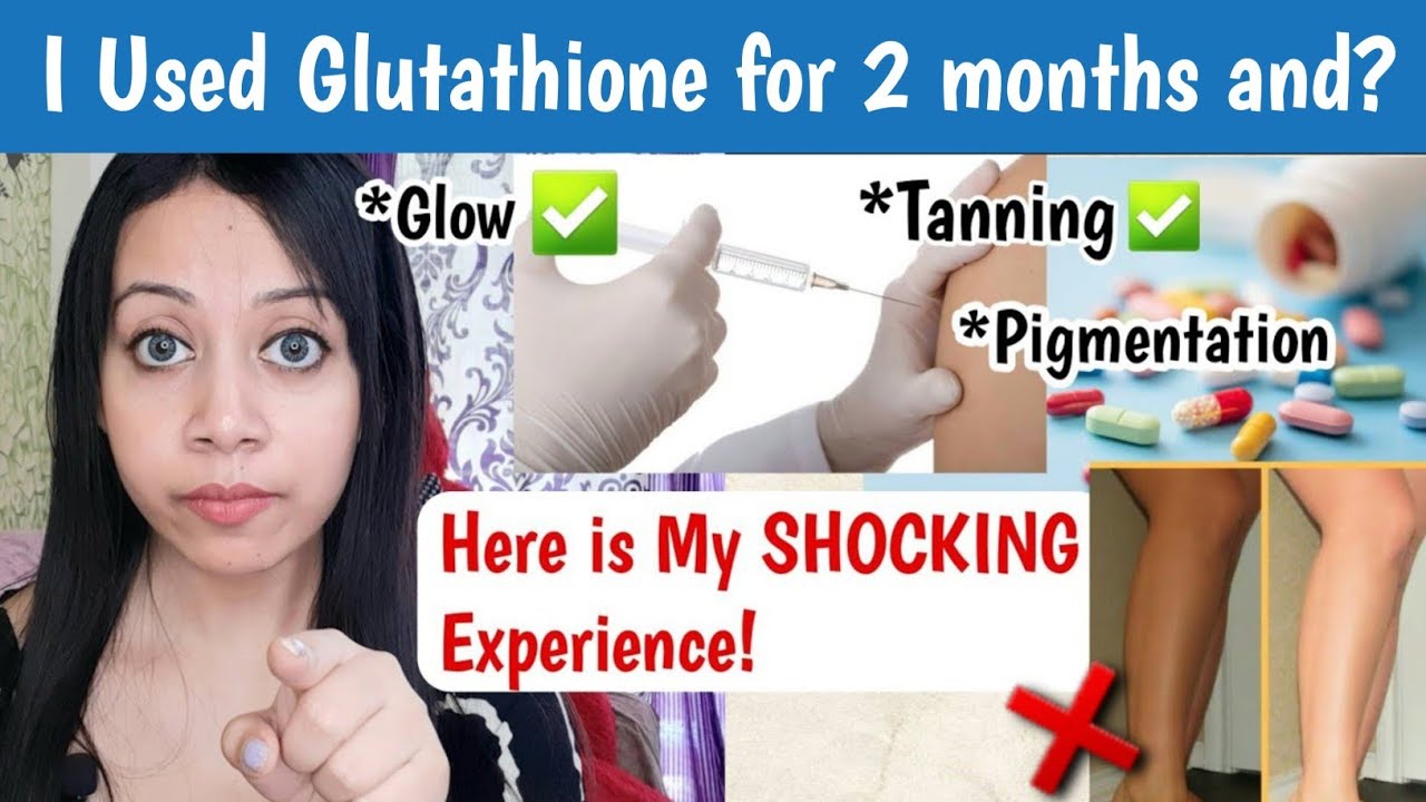 does glutathione remove hyperpigmentation GLUTATHIONE FOR SKIN HYPERPIGMENTATION main image 1