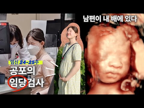 25주 <strong>입체초음파</strong> 키위 얼굴 공개 🥝