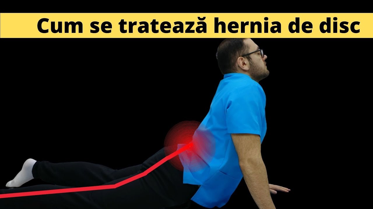 Cum se tratează hernia de disc lombară prin kinetoterapie
