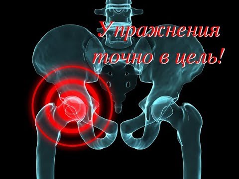 Тазобедренный сустав. Упражнения для здоровья. Оздоровление - народные средства. РОС