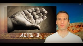 Acts Chapter 3 Summary and What God Wants From Us