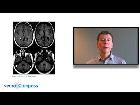 Video: Radiologists Hide The Accumulation Of Heavy Metals On MRI - Alternative View