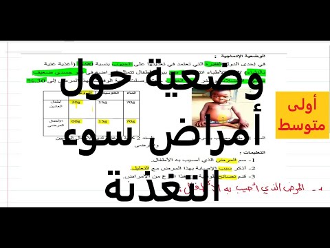 حل وضعية حول أمراض سوء التغذية علوم طبيعية السنة أولى متوسط