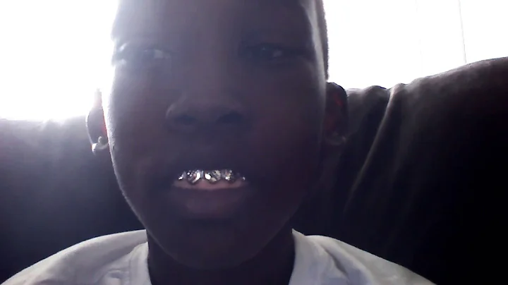 Josiah teeth