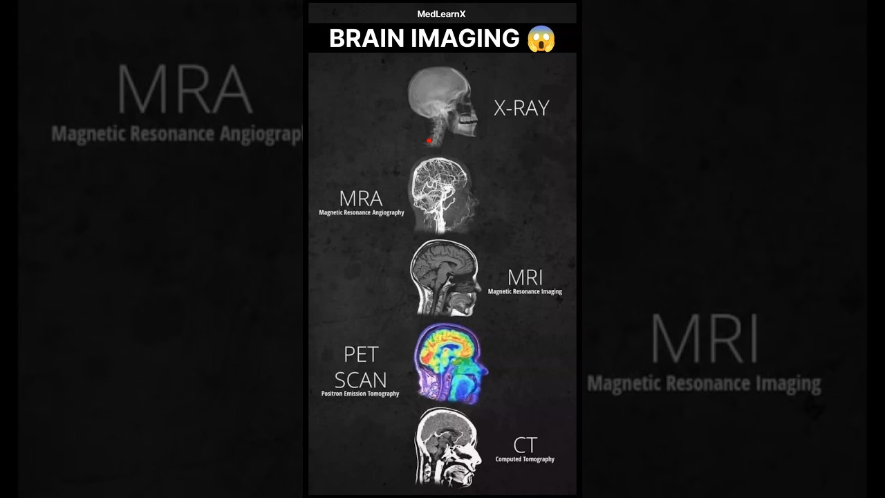 BRAIN IMAGING 😲