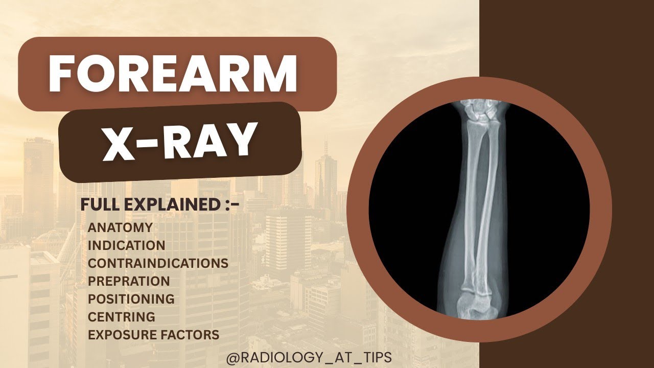 Forearm X-Ray Explained | AP & Lateral Views | Radiology at Tips