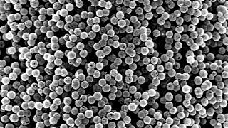 Analisis Scanning Electron Microscope (SEM)