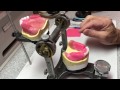 Posterior Denture Tooth Set-Up Lingualized Occlusion