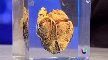 ¿Cómo late el corazón en un pre infarto?