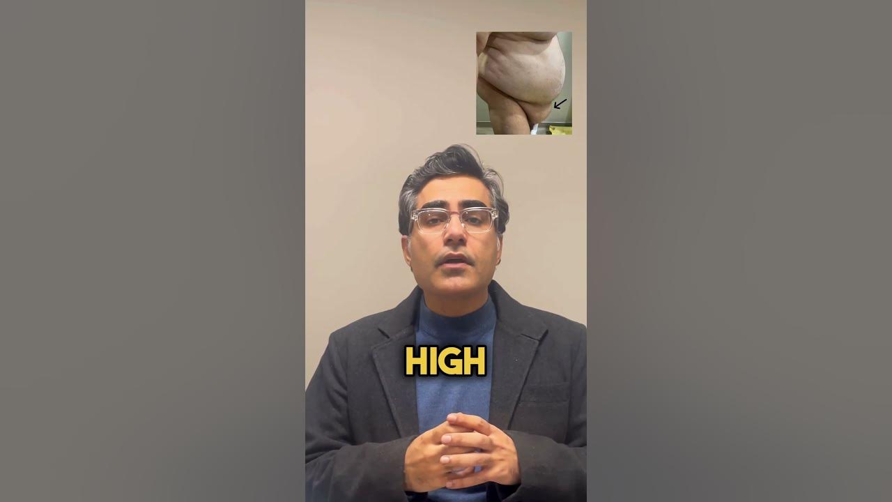 What Type Of Doctor Performs Cholecystectomy