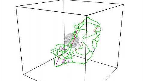 Molecular Dynamics Simulation of Dislocation nucleation in Aluminum-Silicon Carbide nanocomposite