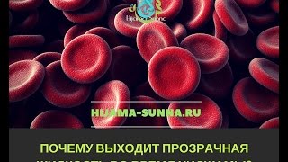 Видео Почему выходит прозрачная жидкость во время хиджамы? (автор: Хиджама Сунна Онлайн Обучение)