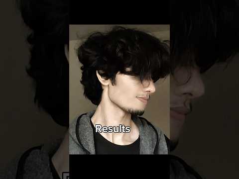 1 year mewing results 😮 subscribe for tutorial ❤️ #glowup #transformation #mewing #jawline #shorts