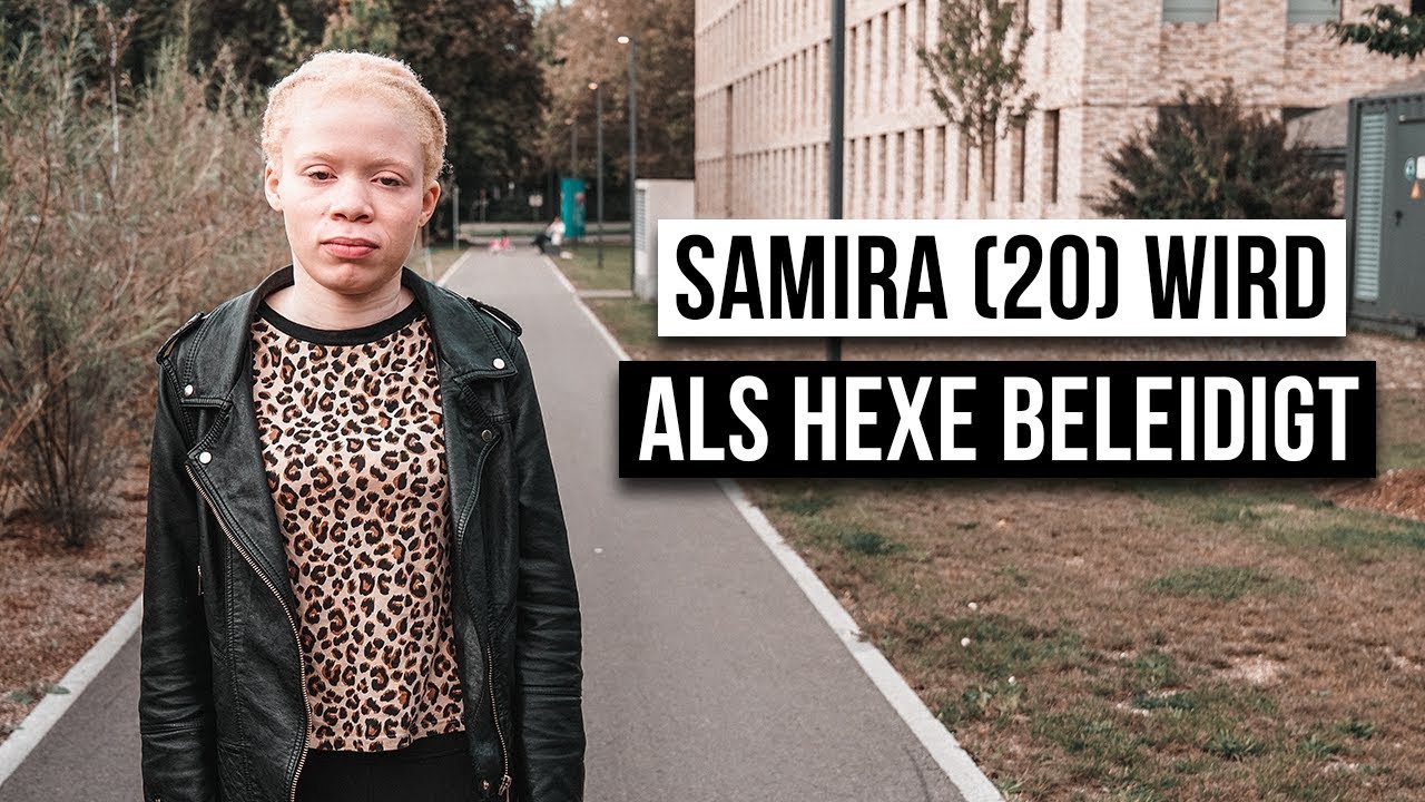 Wie Ist Das Albino Zu Sein Youtube