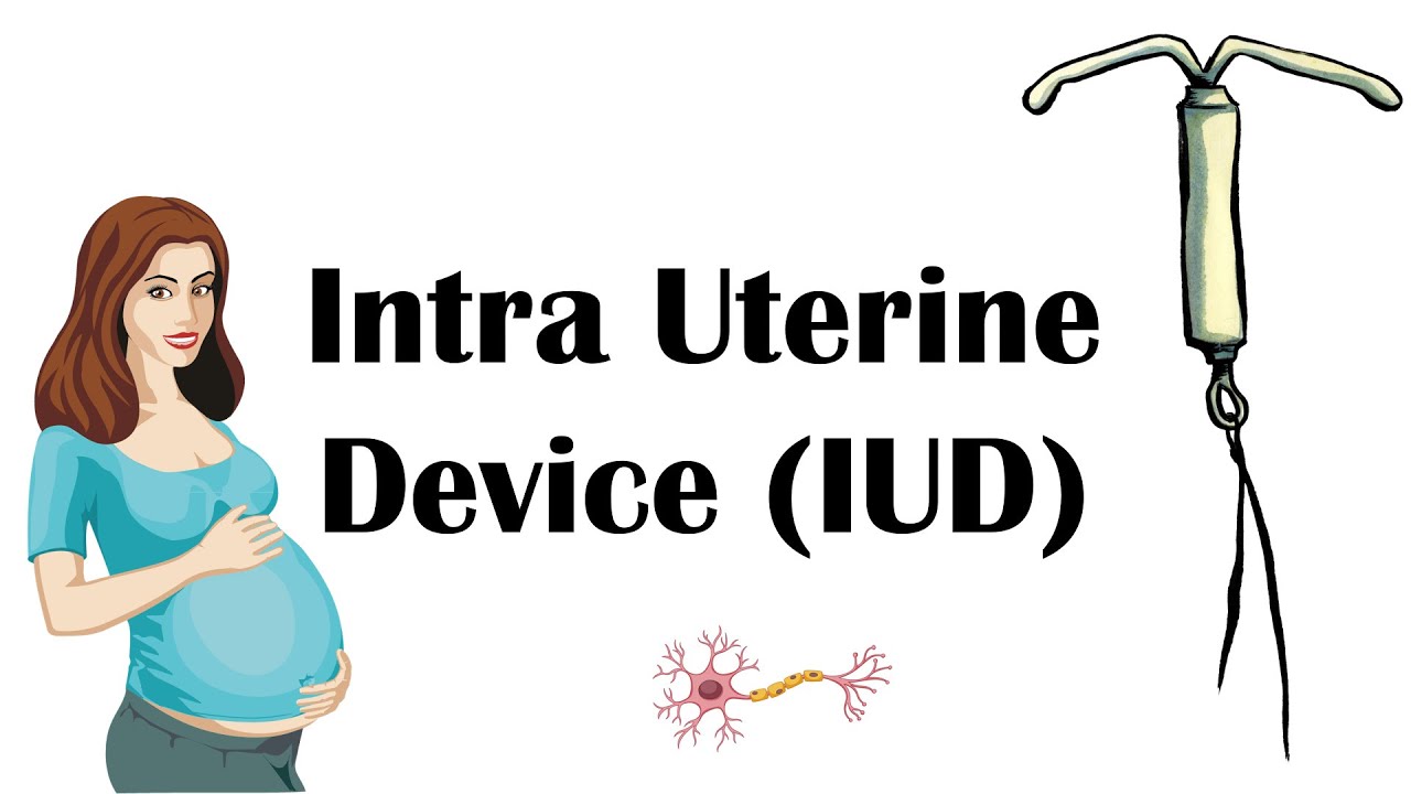 Intra Uterine Contraceptive Device (IUCD/IUD) Types, Uses