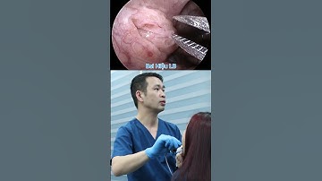 Hóc Xương.cá - Ngày thứ 7 | Bác sĩ Hiệu Long Biên