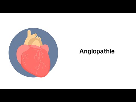 Angiopathie (Mikroangiopathie / Makroangiopathie) - Erkrankungen der Gefäße (mit Infoleiste)