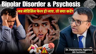 Bipolar Disorder & Psychosis: When Medicines Stop Working? | rTMS Therapy Explained