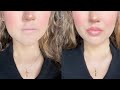 DIY Lip Voluminizer + Anti Falten Kissen SLEEP &amp; GLOW