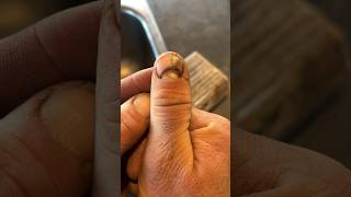 How I Punched a Hole In My Thumb